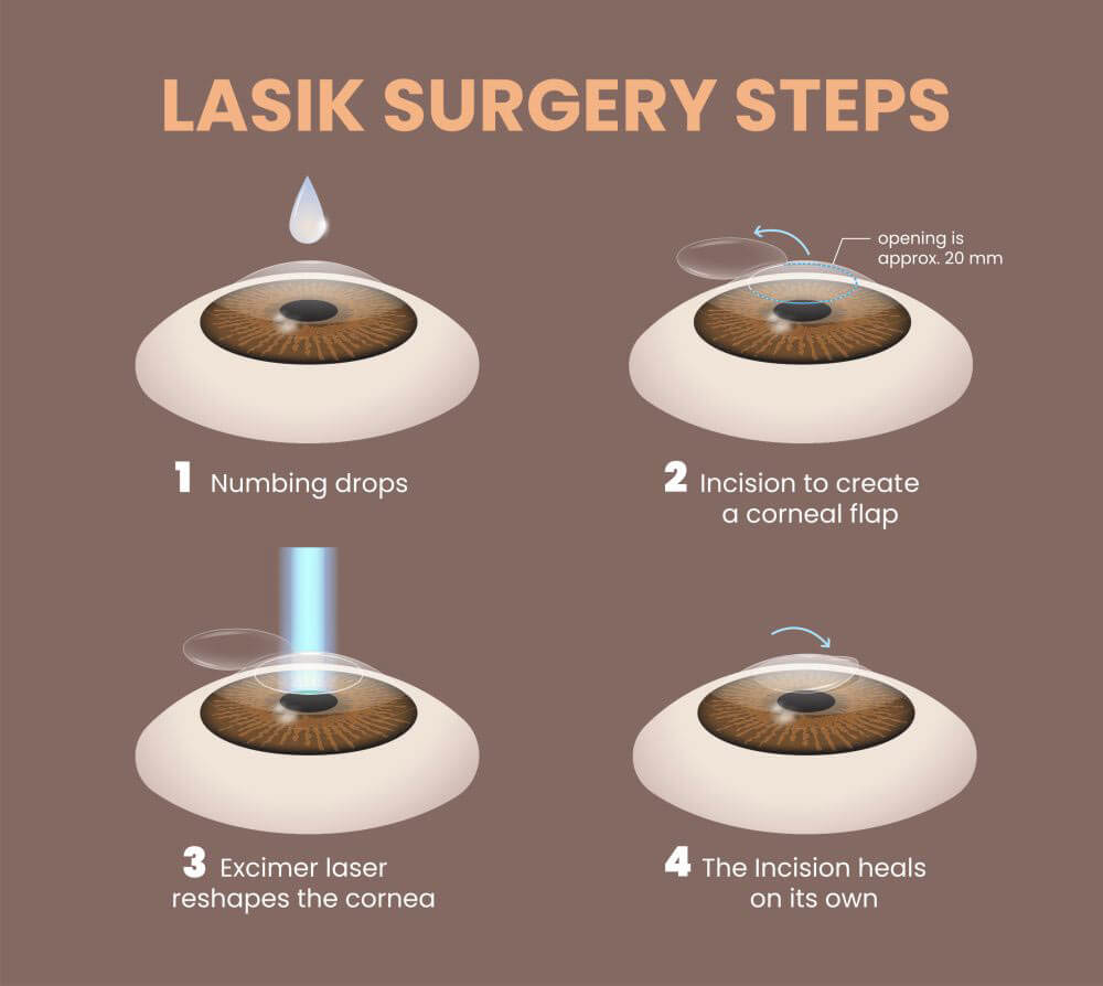 Laser Eye Surgery Clinic Brisbane